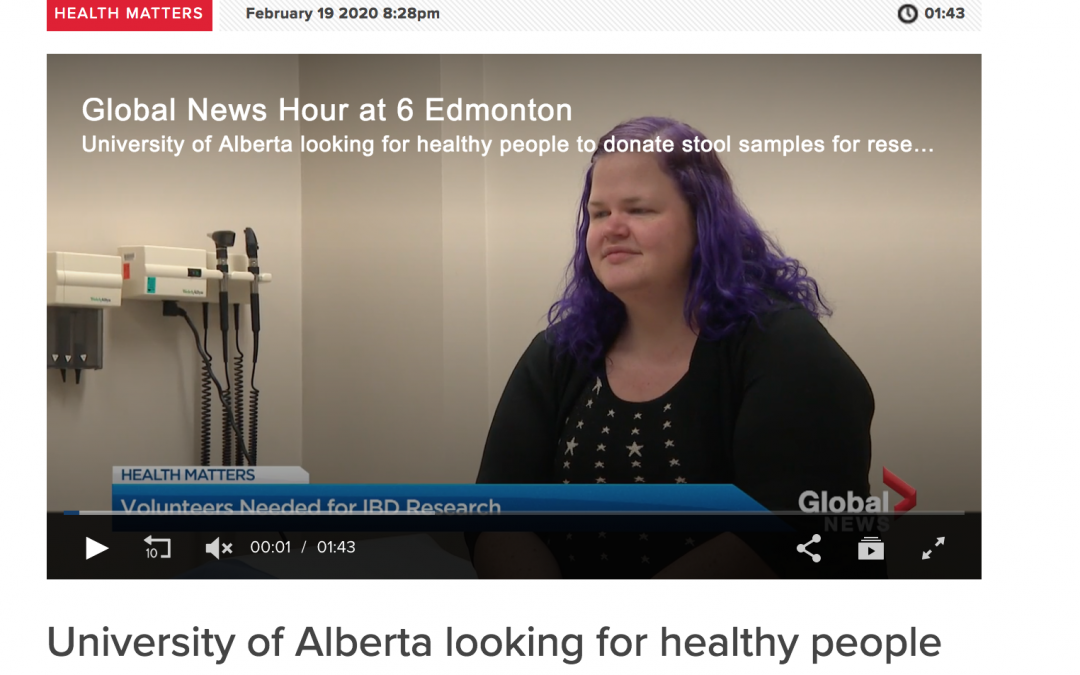 IMAGINE’s Edmonton Site on Global News